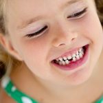 Deciduous Teeth Myths debunked